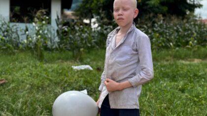 – Albino çocukların bulunduğu yetimhanede kıyafet dağıtımında bulunan İyilikhane Çocuk Derneği gönüllüleri, yemek dağıtımı